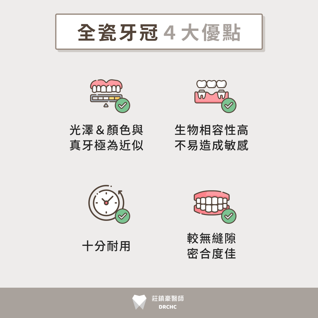 全瓷牙冠 4 大優點