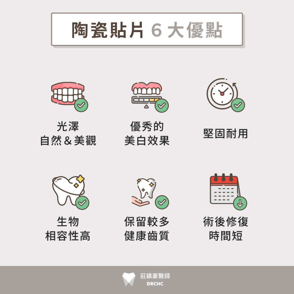 陶瓷貼片6大優點