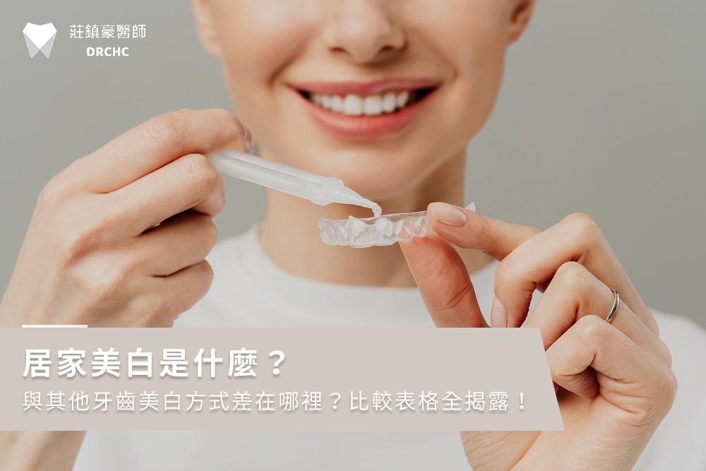 居家美白是什麼？與其他牙齒美白方式差在哪裡？比較表格全揭露！