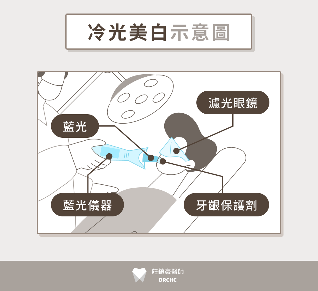 冷光美白療程示意圖