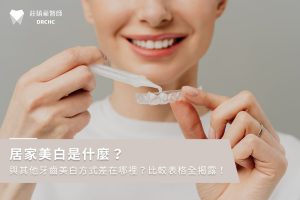 居家美白是什麼？與其他牙齒美白方式差在哪裡？比較表格全揭露！